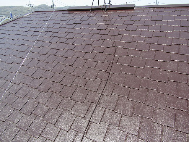 &#23627;&#26681;&#12398;&#22615;&#35013;&#24460;&#12288;&#12450;&#12501;&#12479;&#12540;